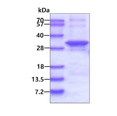 SDS-PAGE: Recombinant Human ARMC10 His Protein [NBP2-22693]